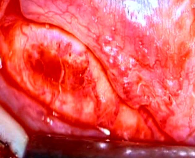 https://cdn.ncbi.nlm.nih.gov/pmc/blobs/3a16/3871753/fe344a833a89/ircmj-15-614-g002.jpg