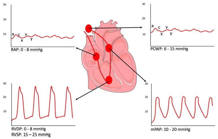 https://cdn.ncbi.nlm.nih.gov/pmc/blobs/3a18/10814482/57590343e90a/diagnostics-14-00136-g001.jpg