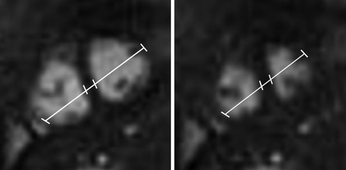 https://cdn.ncbi.nlm.nih.gov/pmc/blobs/3a2f/6916642/f5b63b6319cc/JMRI-51-260-g006.jpg