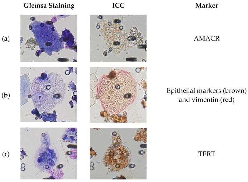 https://cdn.ncbi.nlm.nih.gov/pmc/blobs/3a34/10340459/374efeee454e/cancers-15-03366-g003a.jpg