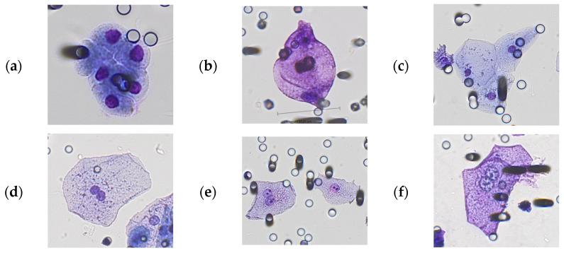 https://cdn.ncbi.nlm.nih.gov/pmc/blobs/3a34/10340459/8dec24401402/cancers-15-03366-g002.jpg