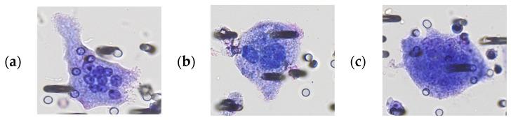 https://cdn.ncbi.nlm.nih.gov/pmc/blobs/3a34/10340459/bcf0f0d280f8/cancers-15-03366-g001a.jpg
