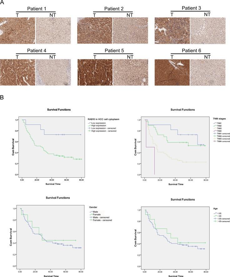 https://cdn.ncbi.nlm.nih.gov/pmc/blobs/3a39/5432270/006df8da8f63/oncotarget-08-26434-g006.jpg