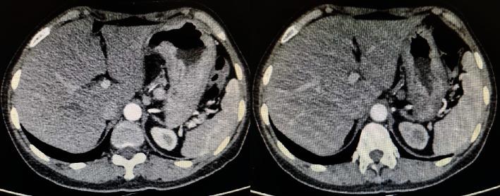 https://cdn.ncbi.nlm.nih.gov/pmc/blobs/3a3c/9076296/66fa611e58ed/DM2022-4322404.003.jpg