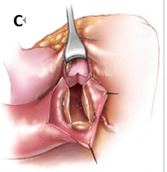 https://cdn.ncbi.nlm.nih.gov/pmc/blobs/3a3d/10268601/15583aa04d3c/fx1.jpg