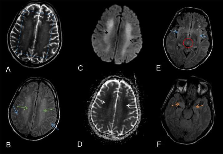 https://cdn.ncbi.nlm.nih.gov/pmc/blobs/3a3d/11378097/e80defa4236c/gr1.jpg