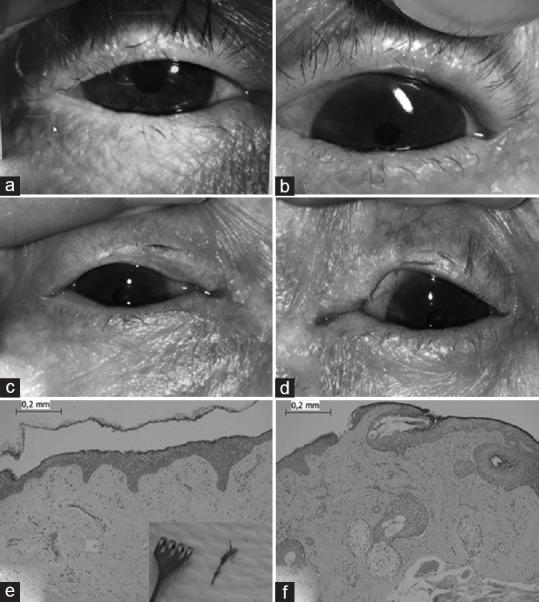 https://cdn.ncbi.nlm.nih.gov/pmc/blobs/3a43/9266477/6f8886679047/SJO-35-347-g001.jpg