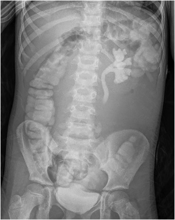 https://cdn.ncbi.nlm.nih.gov/pmc/blobs/3a44/8593222/0978fa9c0da2/gr1.jpg