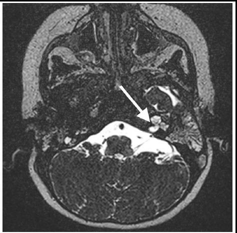 https://cdn.ncbi.nlm.nih.gov/pmc/blobs/3a46/5954383/0b9035f3fe52/PJMS-34-380-g004.jpg
