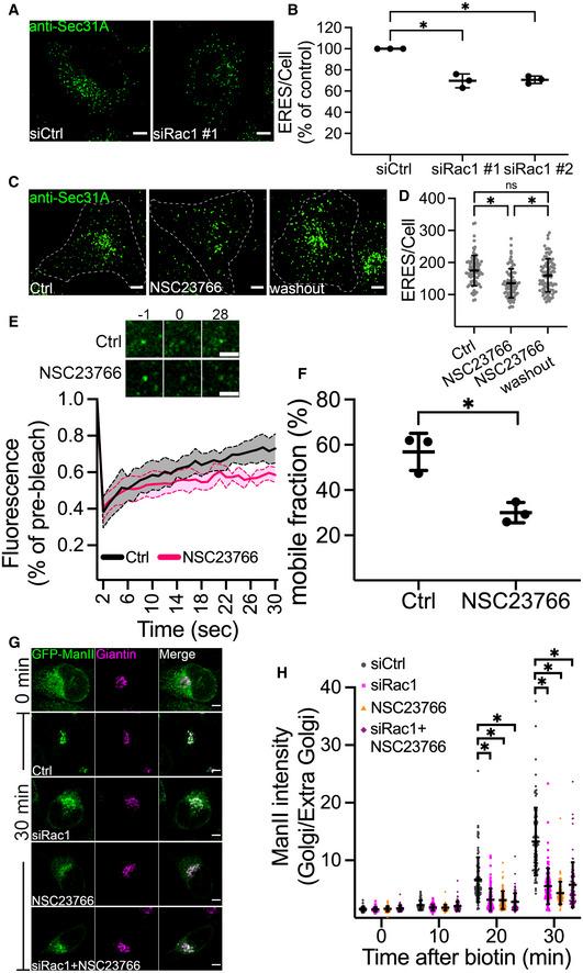 https://cdn.ncbi.nlm.nih.gov/pmc/blobs/3a47/9475550/02ace1ec546a/EMBJ-41-e110596-g013.jpg
