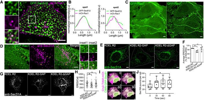 https://cdn.ncbi.nlm.nih.gov/pmc/blobs/3a47/9475550/049ffbd7a49c/EMBJ-41-e110596-g007.jpg