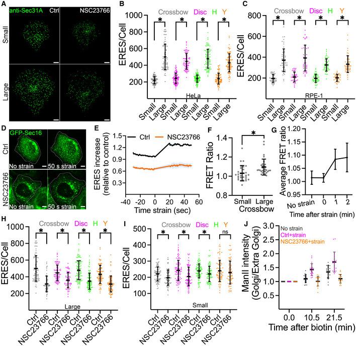 https://cdn.ncbi.nlm.nih.gov/pmc/blobs/3a47/9475550/5f6c4ae9fb3a/EMBJ-41-e110596-g011.jpg