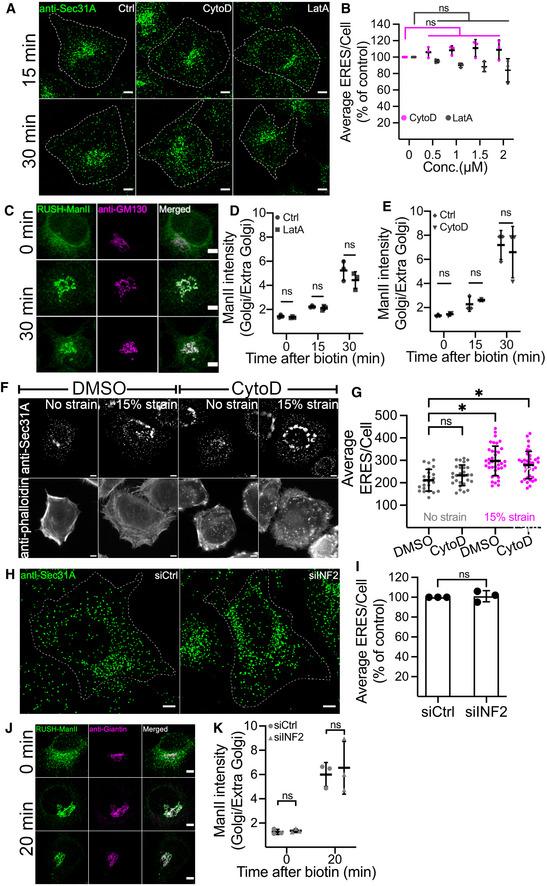 https://cdn.ncbi.nlm.nih.gov/pmc/blobs/3a47/9475550/828689e64920/EMBJ-41-e110596-g006.jpg