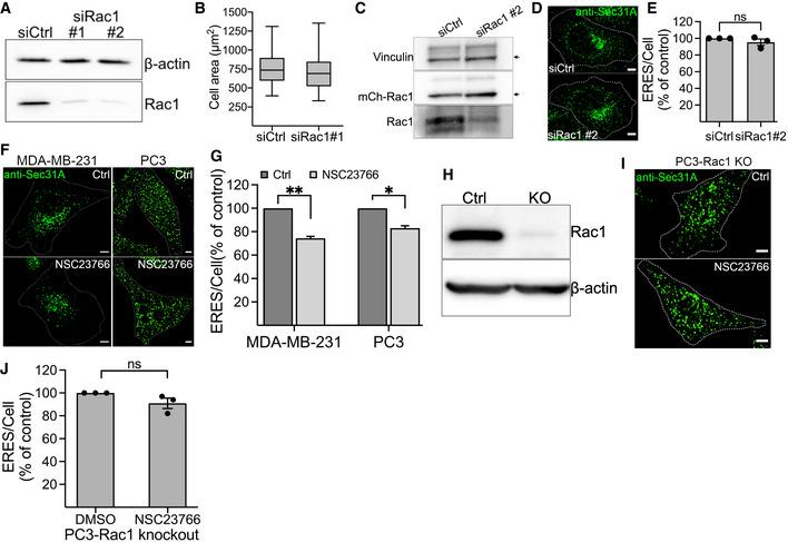 https://cdn.ncbi.nlm.nih.gov/pmc/blobs/3a47/9475550/f8312bae6a3c/EMBJ-41-e110596-g005.jpg