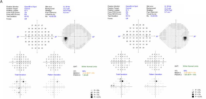 https://cdn.ncbi.nlm.nih.gov/pmc/blobs/3a4b/11719343/186d2378a366/gr1a.jpg