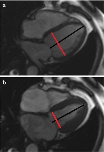 https://cdn.ncbi.nlm.nih.gov/pmc/blobs/3a4c/5460487/3ec8218e6b14/12872_2017_583_Fig3_HTML.jpg
