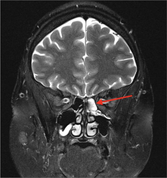 https://cdn.ncbi.nlm.nih.gov/pmc/blobs/3a4f/10927183/eb0e12665835/SNI-15-61-g001.jpg