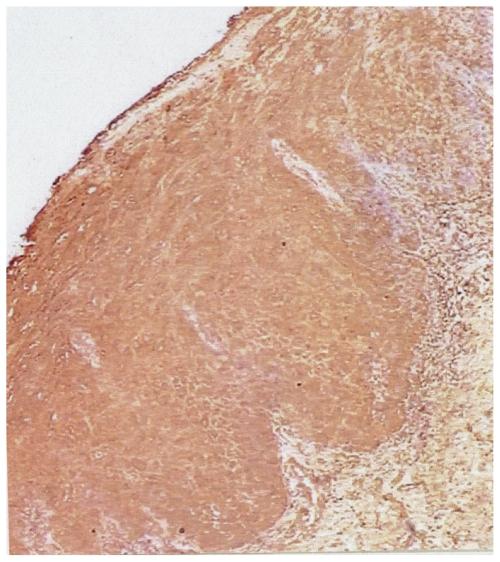 https://cdn.ncbi.nlm.nih.gov/pmc/blobs/3a50/3161688/91044f139b69/cmo-2-2008-159f3.jpg