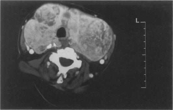 https://cdn.ncbi.nlm.nih.gov/pmc/blobs/3a51/2503525/95874b7cd99a/annrcse01624-0076-a.jpg