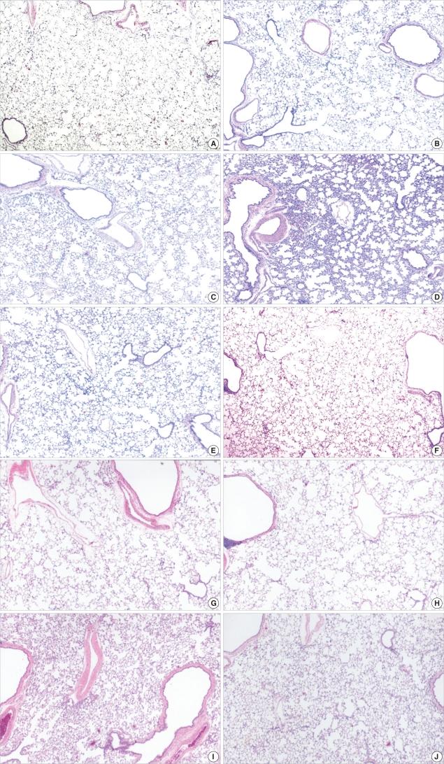 https://cdn.ncbi.nlm.nih.gov/pmc/blobs/3a55/2526521/c942c8dfe743/jkms-23-406-g003.jpg