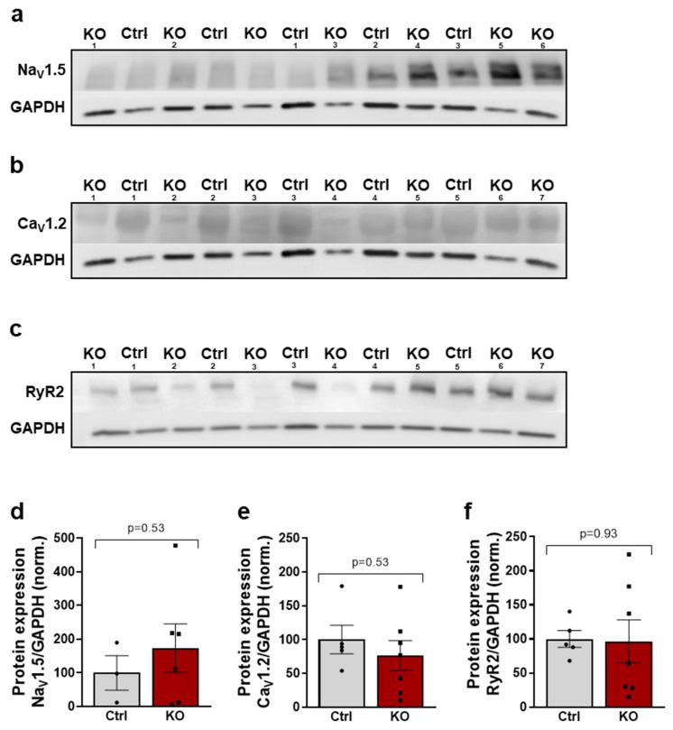 https://cdn.ncbi.nlm.nih.gov/pmc/blobs/3a5c/10299073/0d3f2a646541/ijms-24-10189-g006.jpg