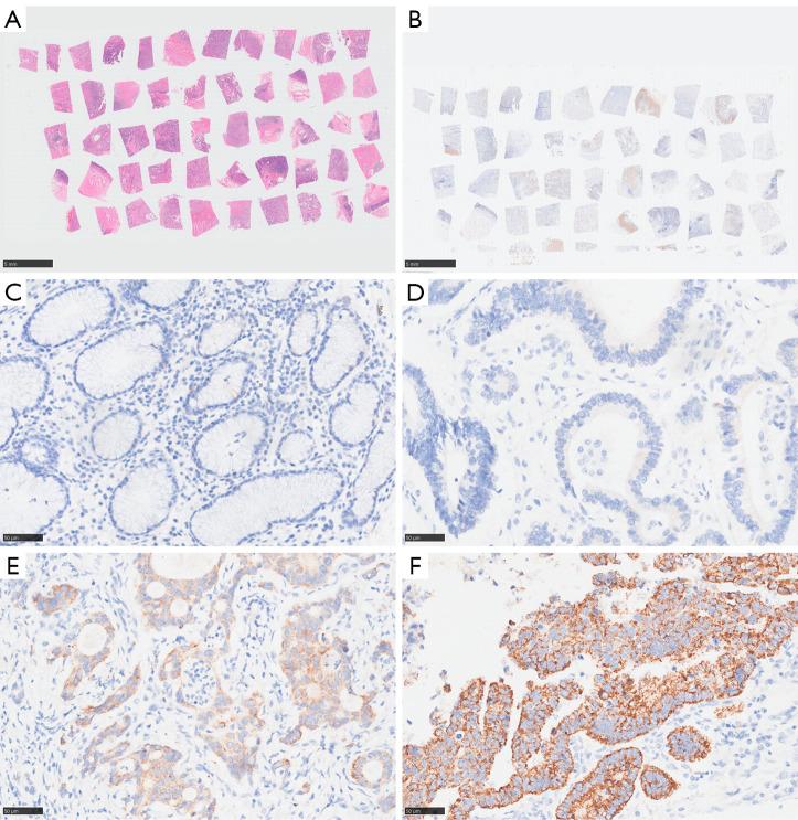 https://cdn.ncbi.nlm.nih.gov/pmc/blobs/3a5c/12170108/9f2cdf7f7351/tcr-14-05-3069-f7.jpg