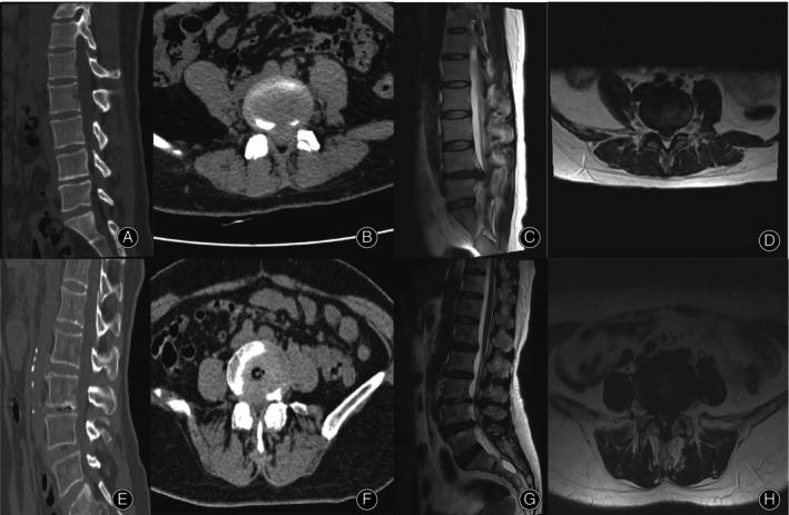 https://cdn.ncbi.nlm.nih.gov/pmc/blobs/3a67/11293918/35211a8936e5/OS-16-1999-g001.jpg