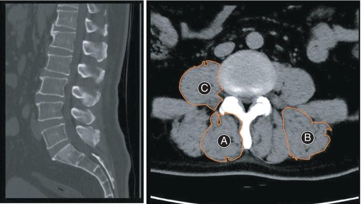 https://cdn.ncbi.nlm.nih.gov/pmc/blobs/3a67/11293918/ef887c29142f/OS-16-1999-g004.jpg