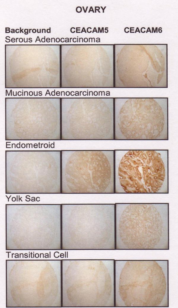 https://cdn.ncbi.nlm.nih.gov/pmc/blobs/3a6a/1769503/03a6807aead7/1471-2407-7-2-6.jpg