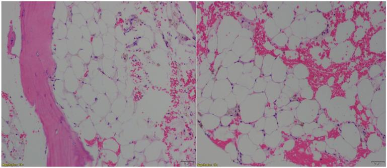 https://cdn.ncbi.nlm.nih.gov/pmc/blobs/3a76/9638685/bc1177640da0/10.1177_23247096221127114-fig5.jpg