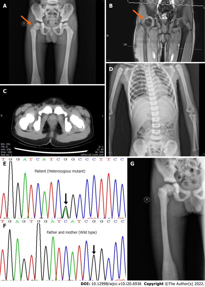 https://cdn.ncbi.nlm.nih.gov/pmc/blobs/3a77/9297392/ab167a058d3d/WJCC-10-6936-g001.jpg