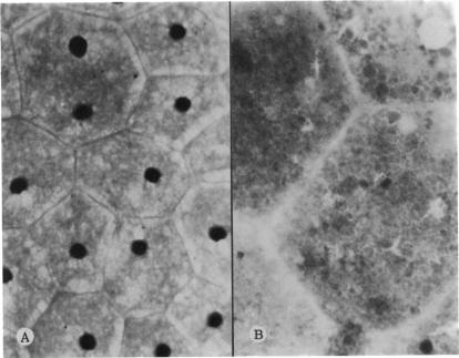 https://cdn.ncbi.nlm.nih.gov/pmc/blobs/3a80/1311407/241976cd4f8d/taos00027-0442-a.jpg