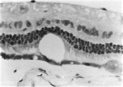 https://cdn.ncbi.nlm.nih.gov/pmc/blobs/3a80/1311407/5120ab547c01/taos00027-0447-a.jpg