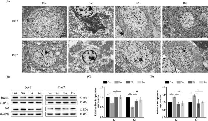 https://cdn.ncbi.nlm.nih.gov/pmc/blobs/3a81/11862894/6f6b49ae1a7d/JCMM-29-e70436-g001.jpg