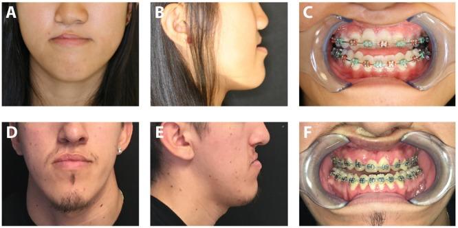 https://cdn.ncbi.nlm.nih.gov/pmc/blobs/3a82/6450464/3d30d17a6f53/fphys-10-00322-g003.jpg