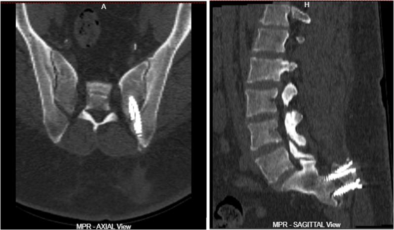 https://cdn.ncbi.nlm.nih.gov/pmc/blobs/3a88/11929886/60c8315a2db5/gr2.jpg