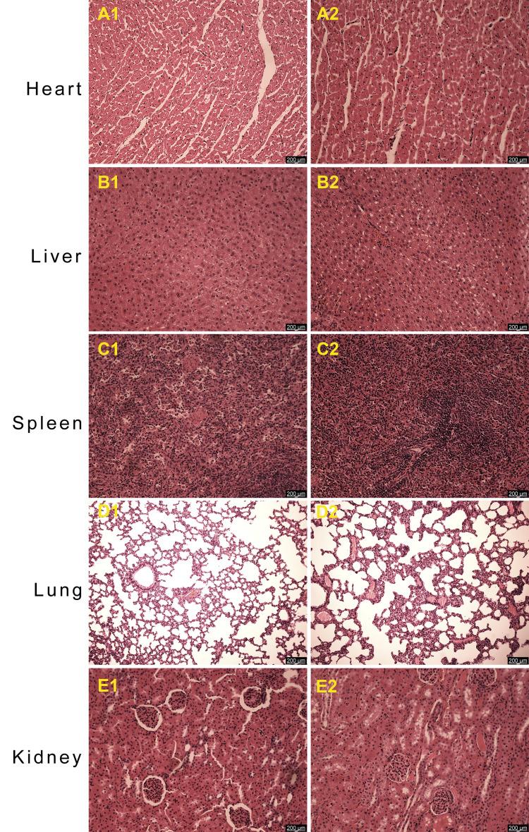 https://cdn.ncbi.nlm.nih.gov/pmc/blobs/3a89/9059993/478d8b1abe39/JIR-15-2745-g0006.jpg