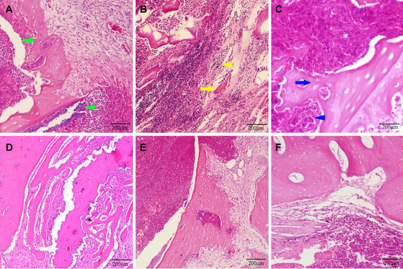 https://cdn.ncbi.nlm.nih.gov/pmc/blobs/3a89/9059993/61b98fccb4e6/JIR-15-2745-g0005.jpg