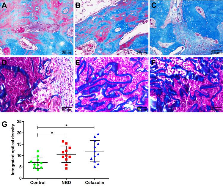 https://cdn.ncbi.nlm.nih.gov/pmc/blobs/3a89/9059993/da53380da6a6/JIR-15-2745-g0007.jpg