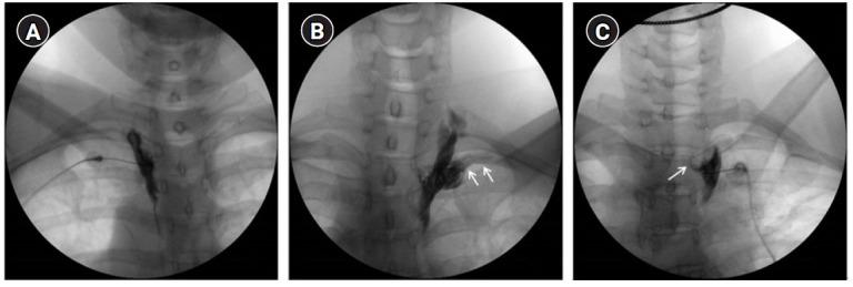 https://cdn.ncbi.nlm.nih.gov/pmc/blobs/3a8a/7724114/a9e1a2e269e0/apm-20052f1.jpg