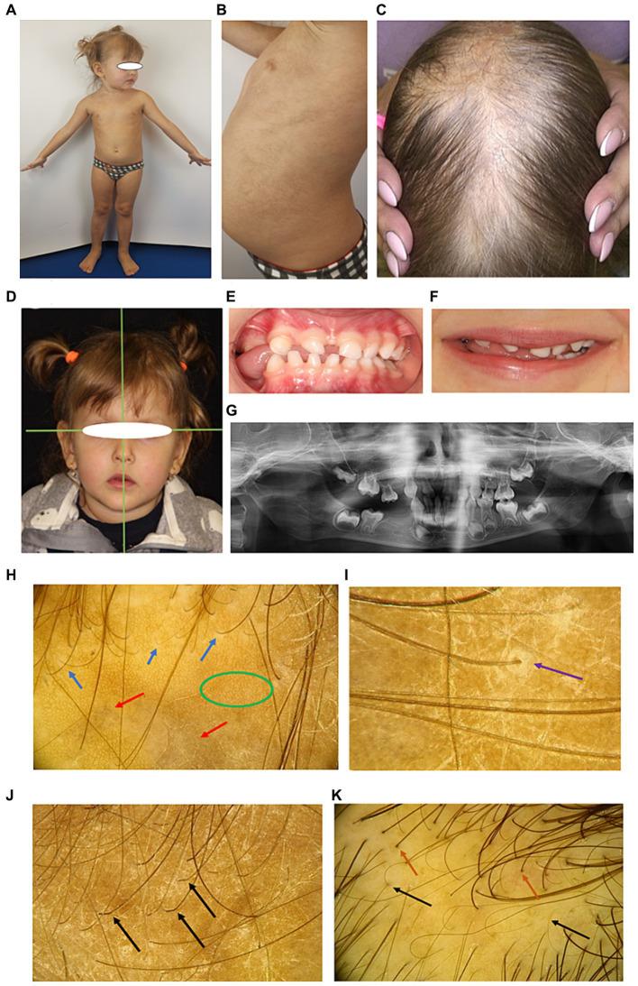 https://cdn.ncbi.nlm.nih.gov/pmc/blobs/3a8b/11288940/68a0f46129d8/fmed-11-1402577-g003.jpg