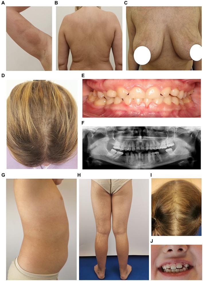 https://cdn.ncbi.nlm.nih.gov/pmc/blobs/3a8b/11288940/713e3b287ac1/fmed-11-1402577-g002.jpg