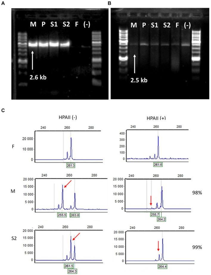 https://cdn.ncbi.nlm.nih.gov/pmc/blobs/3a8b/11288940/a6a5ddc18320/fmed-11-1402577-g004.jpg