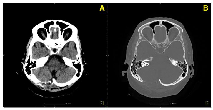 https://cdn.ncbi.nlm.nih.gov/pmc/blobs/3a8b/11728124/e6487947e7f4/jcm-13-07525-g003.jpg