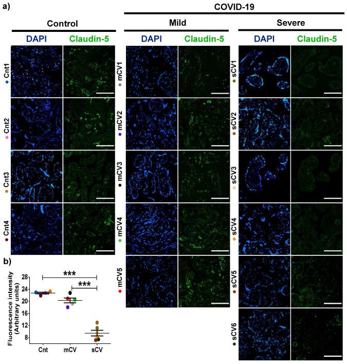 https://cdn.ncbi.nlm.nih.gov/pmc/blobs/3a98/7916402/3125fa536a7b/cells-10-00364-g004.jpg