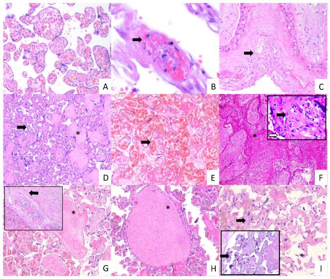 https://cdn.ncbi.nlm.nih.gov/pmc/blobs/3a98/7916402/5a0c126f827b/cells-10-00364-g007.jpg