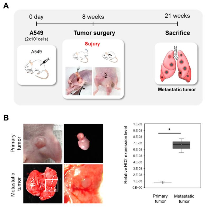 https://cdn.ncbi.nlm.nih.gov/pmc/blobs/3a9e/10366764/8940bed6a2dc/tomography-09-00096-g002.jpg