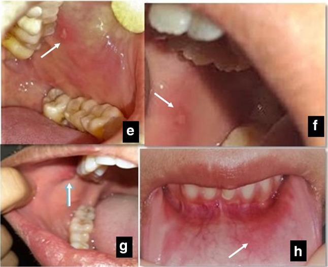 https://cdn.ncbi.nlm.nih.gov/pmc/blobs/3aa1/9989059/c53006ff211a/12663_2021_1679_Fig2_HTML.jpg
