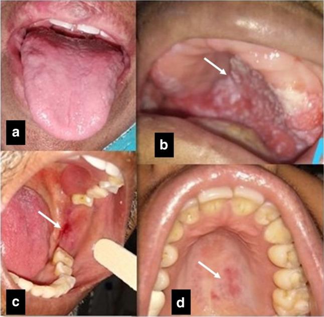https://cdn.ncbi.nlm.nih.gov/pmc/blobs/3aa1/9989059/fcda189abcd9/12663_2021_1679_Fig1_HTML.jpg