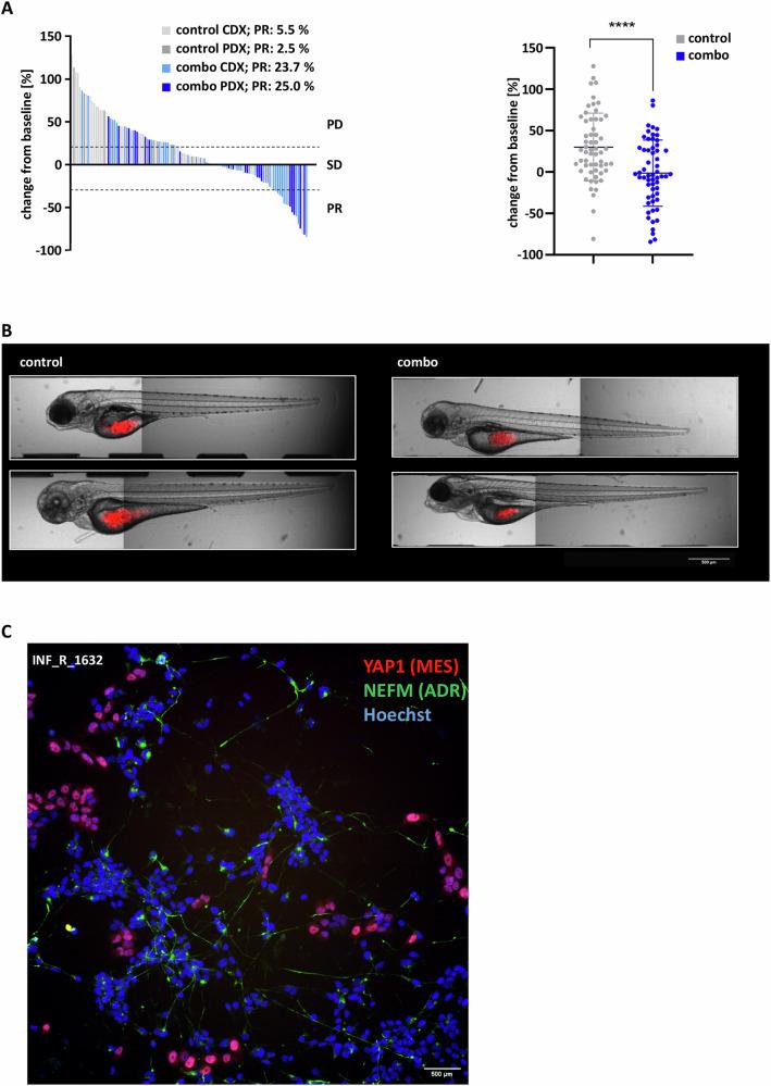 https://cdn.ncbi.nlm.nih.gov/pmc/blobs/3aa3/12379013/e5ea61956fa0/41419_2025_7933_Fig5_HTML.jpg